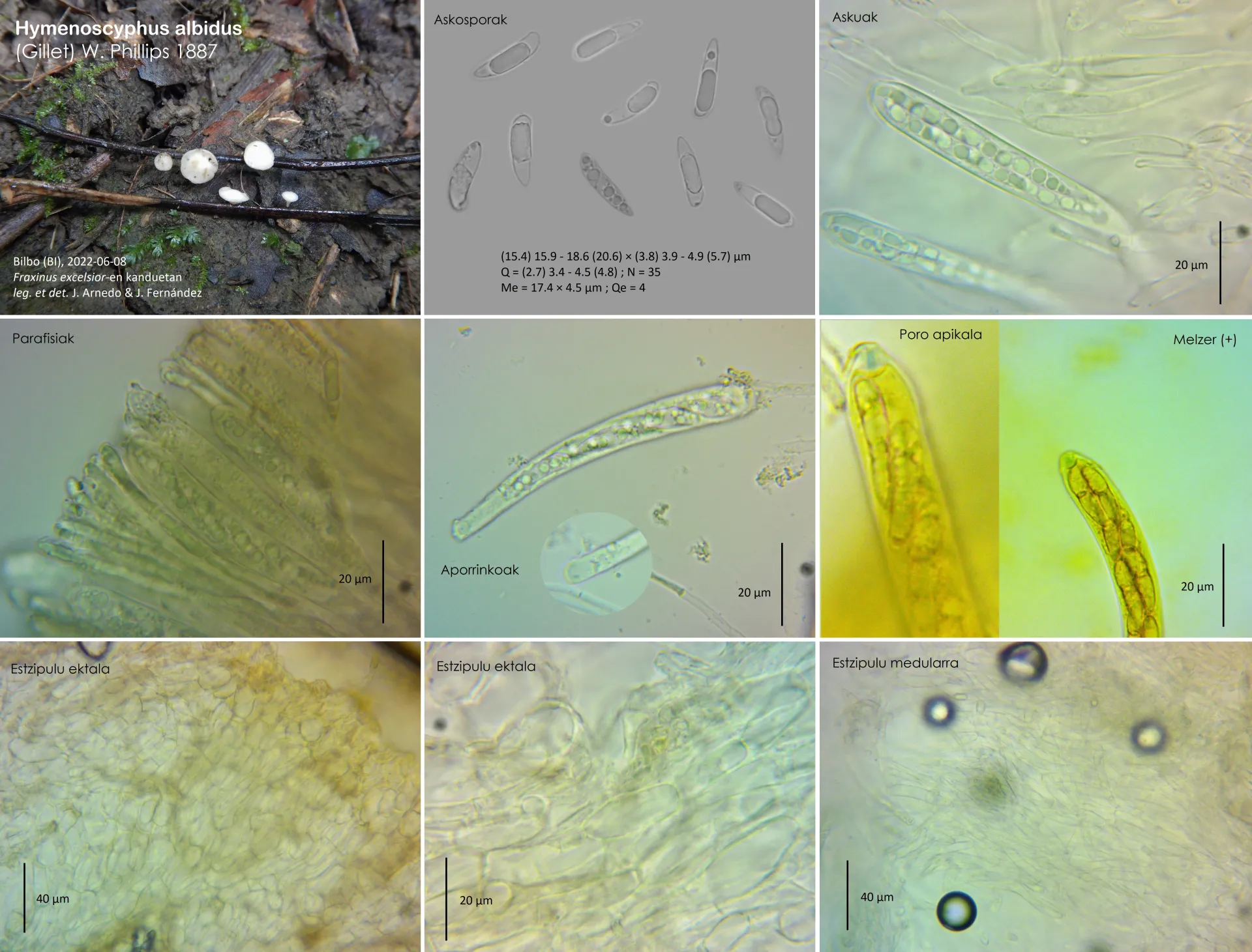 Microscopía de Hymenoscyphus albidus,